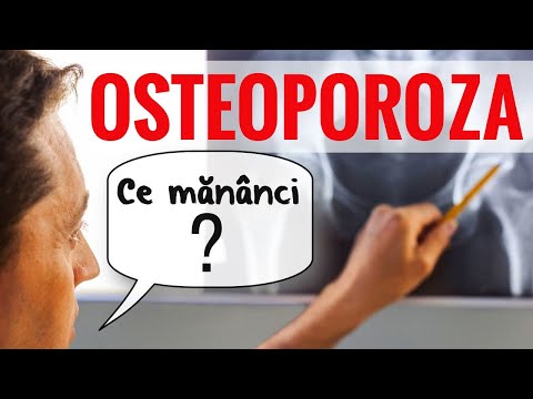 OSTEOPOROZA. Ce dietă te ajută să o previi?