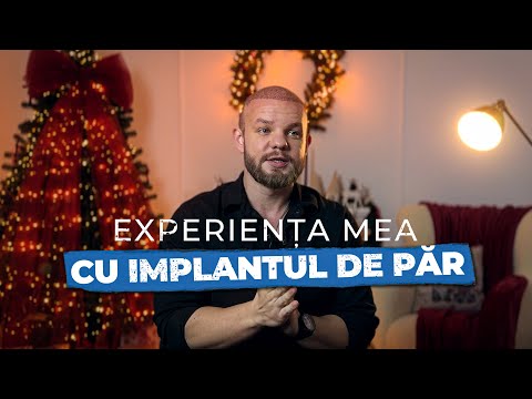 Cât Costă un Implant de Păr? Experiența Mea și Tot ce Trebuie să Stii!