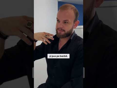 Implantul de păr: Ce trebuie să știi? 💡